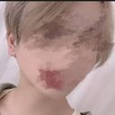 Rt（イメチェン後）