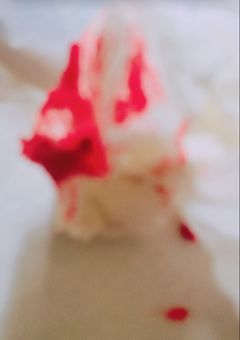 自傷行為。こんなのもう辞めたい
