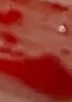 病