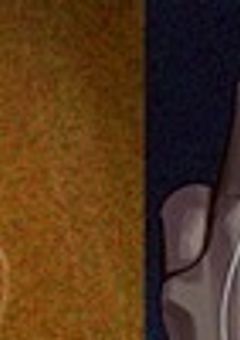 涙花病と吐石病の君