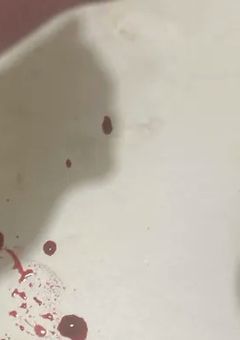 　»　嫉
