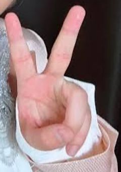 歯医者嫌いの凉架くん